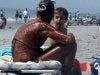 sunburn.jpg