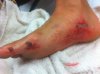 My Foot2 2014.01.05.JPG