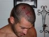 busted head.jpg