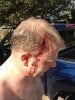 fin injury.jpg