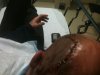 Head gash After.jpg